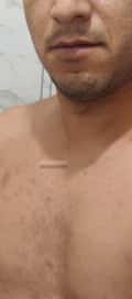 Acompanhante Nunes