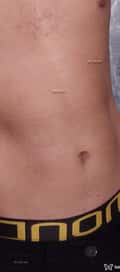 Acompanhante Thiago