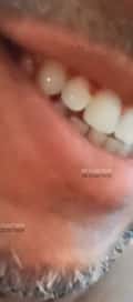 Acompanhante Inciante