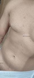 Acompanhante Fernando Alves
