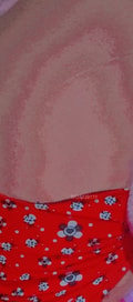 Acompanhante Aninha