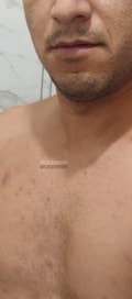 Acompanhante Nunes