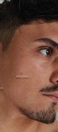 Acompanhante Ravizinho