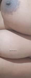 Acompanhante Casallesbica