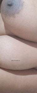 Acompanhante Casallesbica