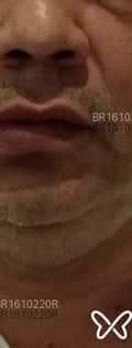 Acompanhante Niel
