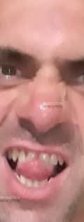Acompanhante Lobomal