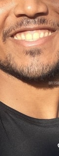 Acompanhante Carlos Henrique