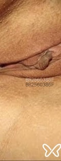 Acompanhante Ana Luiza