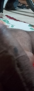 Acompanhante Pirulito