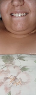 Acompanhante Aline