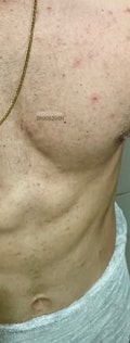 Acompanhante Pedro Lorato