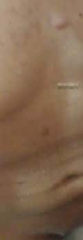 Acompanhante Lukas Maldone