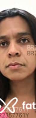 Acompanhante Kesinha