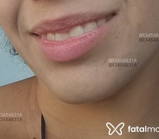 Acompanhante em Linhares-ES - Tatyane