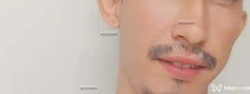 Allvessh Acompanhante Allvessh - Cabeçalho