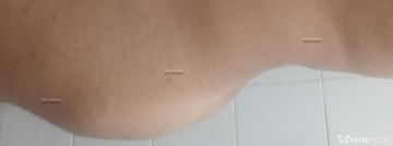Esfola pau Acompanhante Esfola pau - Cabeçalho