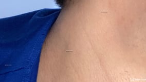 Zack Martin Acompanhante Zack Martin - Cabeçalho