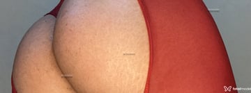 Novinhoanapls Acompanhante Novinhoanapls - Cabeçalho