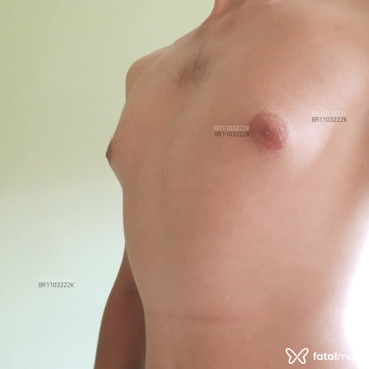 Acompanhante Thiago - Feed