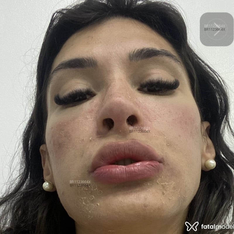 Acompanhante Mayte Gama - Feed