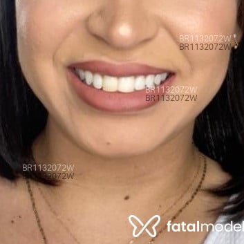 Acompanhante Camila borges - Feed