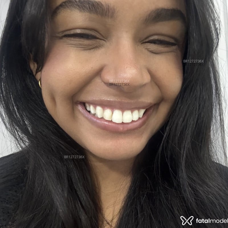 Acompanhante Ayla - Feed