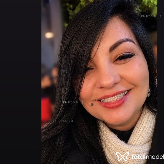 Acompanhante Morena Mel - Feed