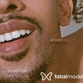 Acompanhante Henrique - Feed