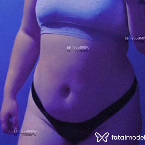 Acompanhante Aninha - Feed