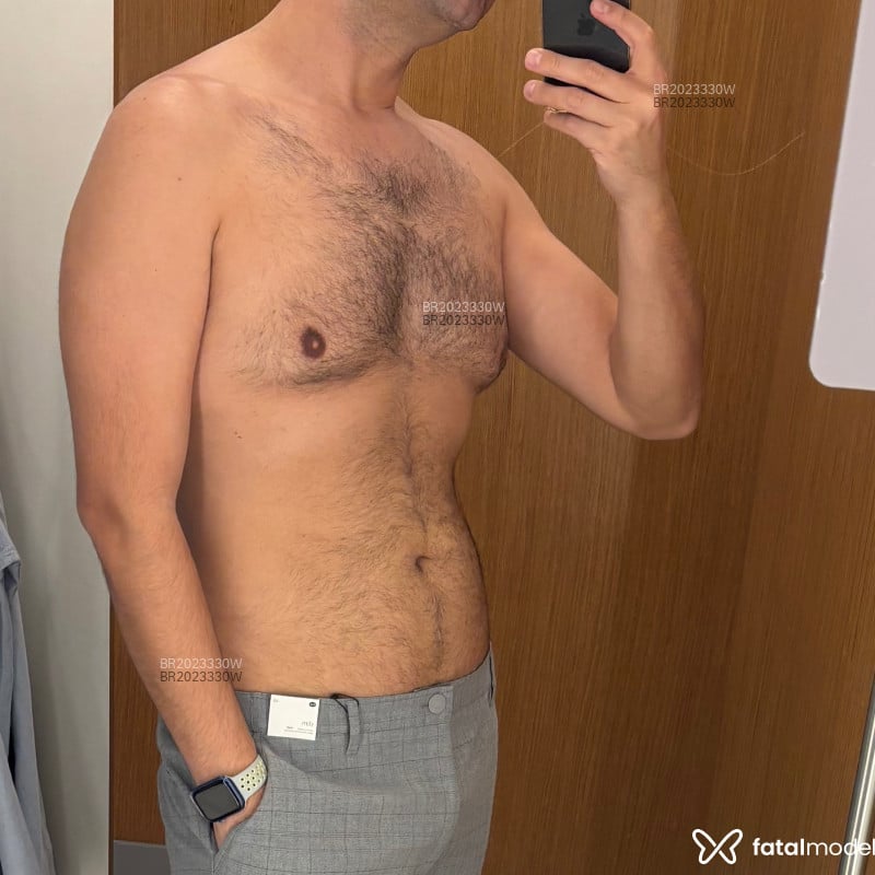 Acompanhante Bruno Dias - Feed
