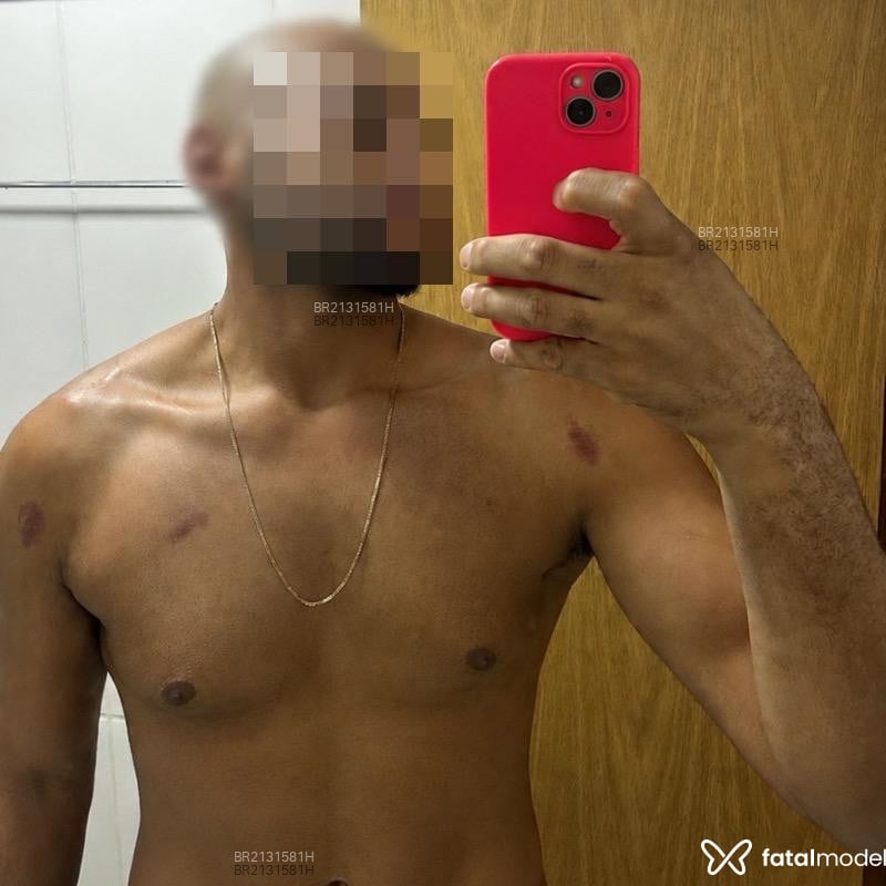 Acompanhante Gustavo Henrique - Feed