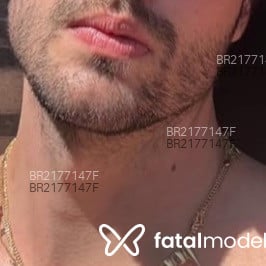 Acompanhante Gutinho - Feed