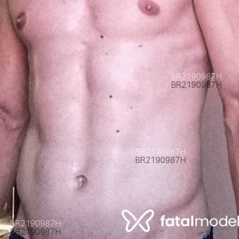 Acompanhante Patrick - Feed