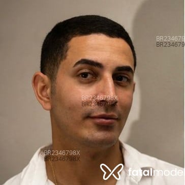 Acompanhante Patrick Costa - Feed
