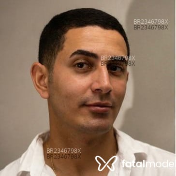 Acompanhante Patrick Costa - Feed
