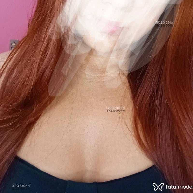 Acompanhante Flozinha - Feed
