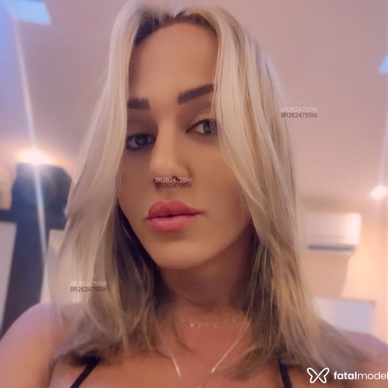 Acompanhante Babinha - Feed
