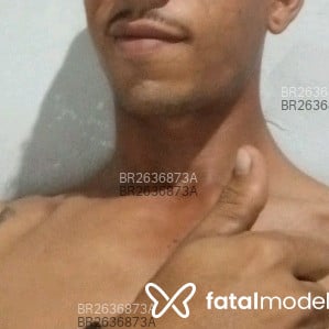 Acompanhante Matheus Rolud - Feed