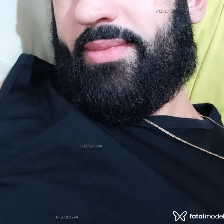 Acompanhante Ralph Don - Feed