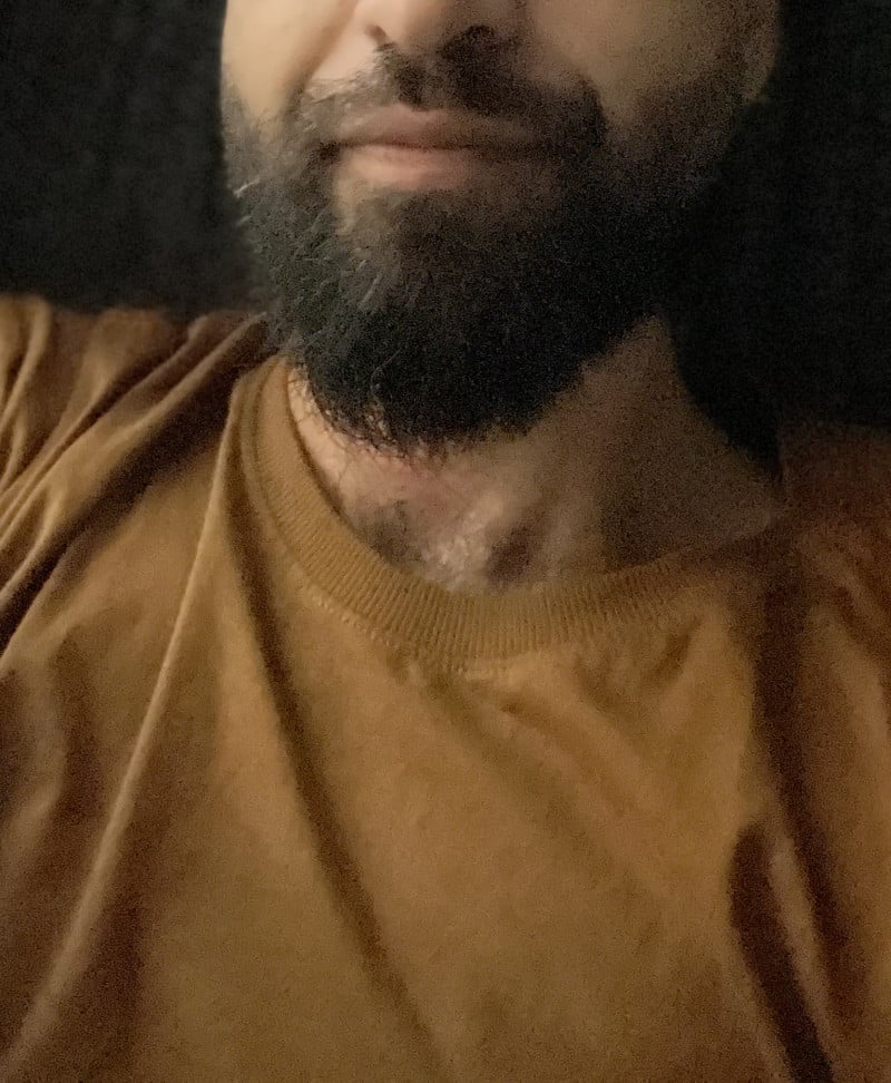 Acompanhante Peludinho Cb - Feed