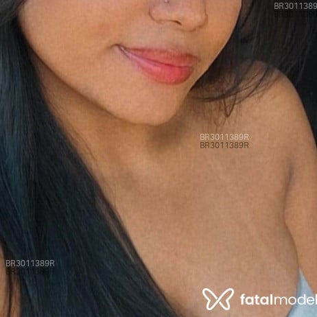 Acompanhante Bruninha - Feed