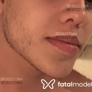 Acompanhante Matheus Sousa - Feed