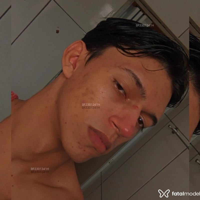 Acompanhante Betão - Feed