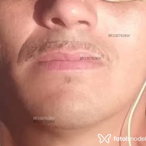Acompanhante Leandro Brasão - Feed