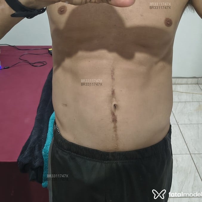 Acompanhante Miguel Santos - Feed