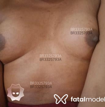 Acompanhante Patty Dotadaa - Feed
