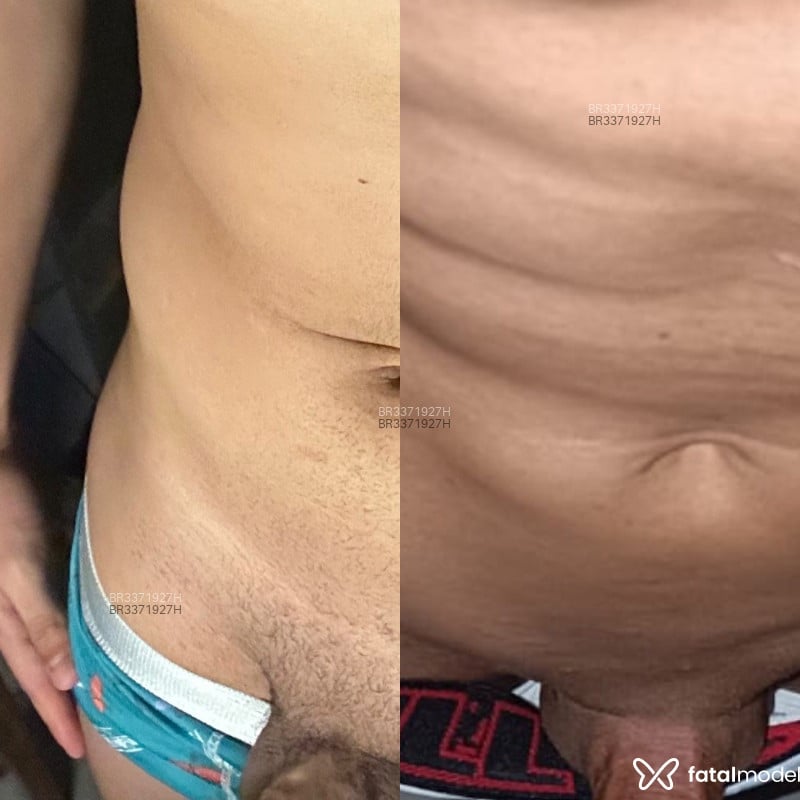 Acompanhante Matheus - Feed