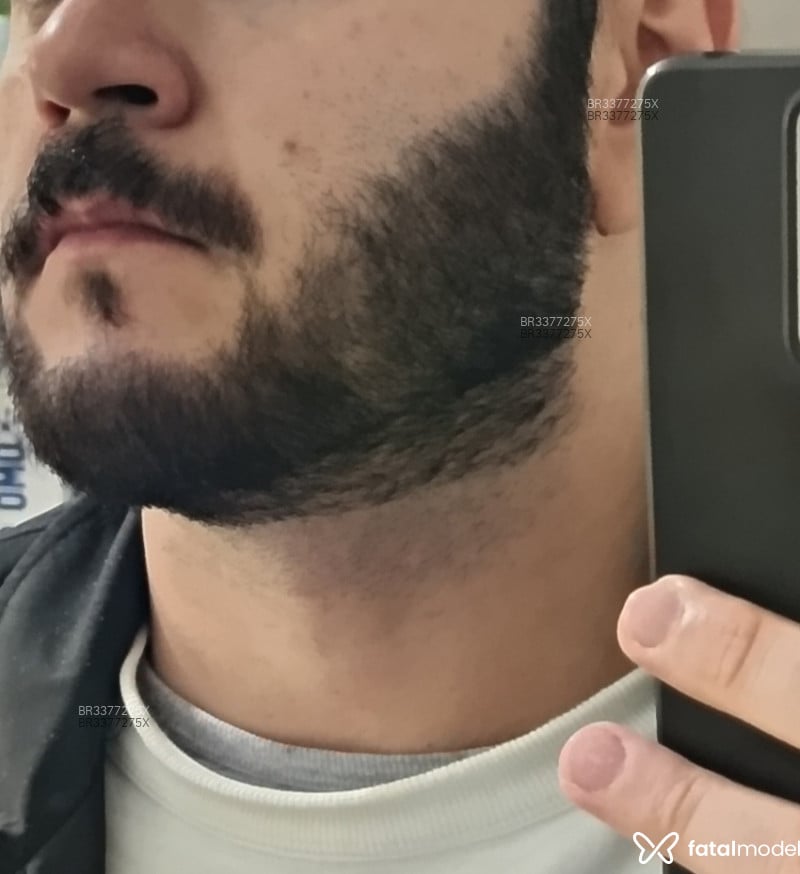 Acompanhante Carvalho - Feed