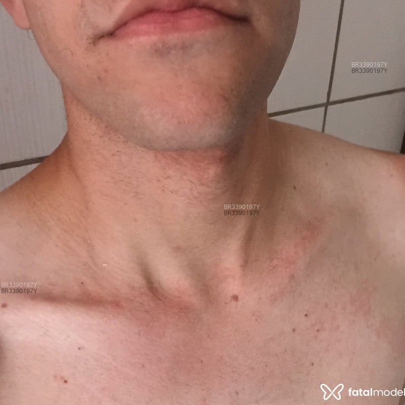 Acompanhante Greg - Feed